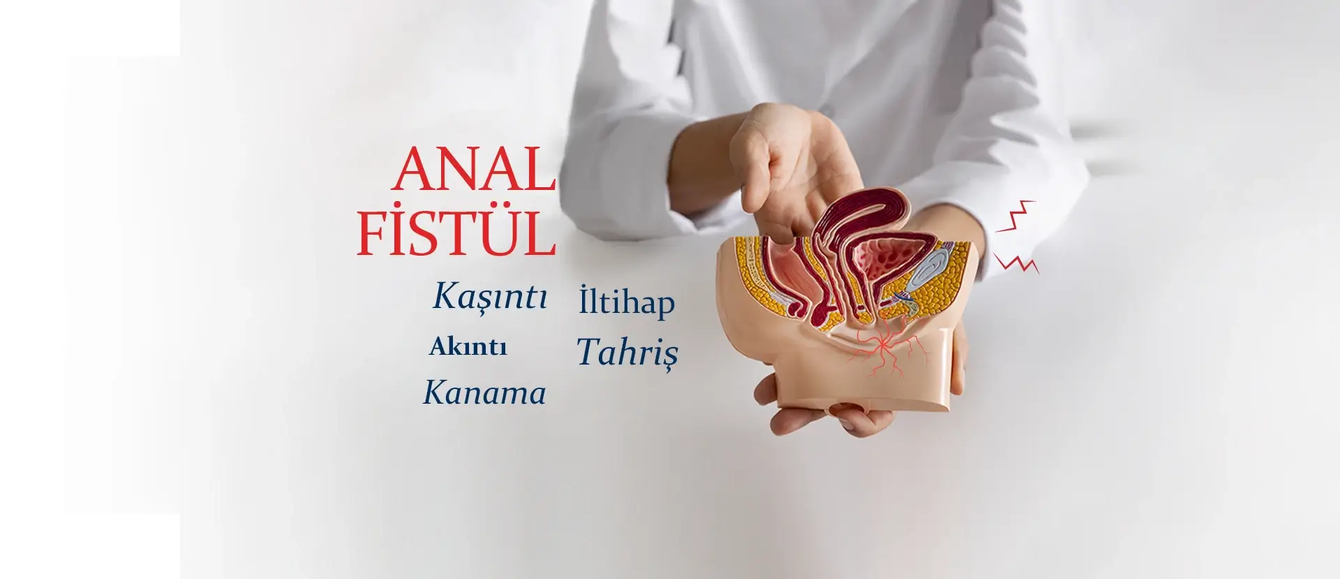 Anal Fistül