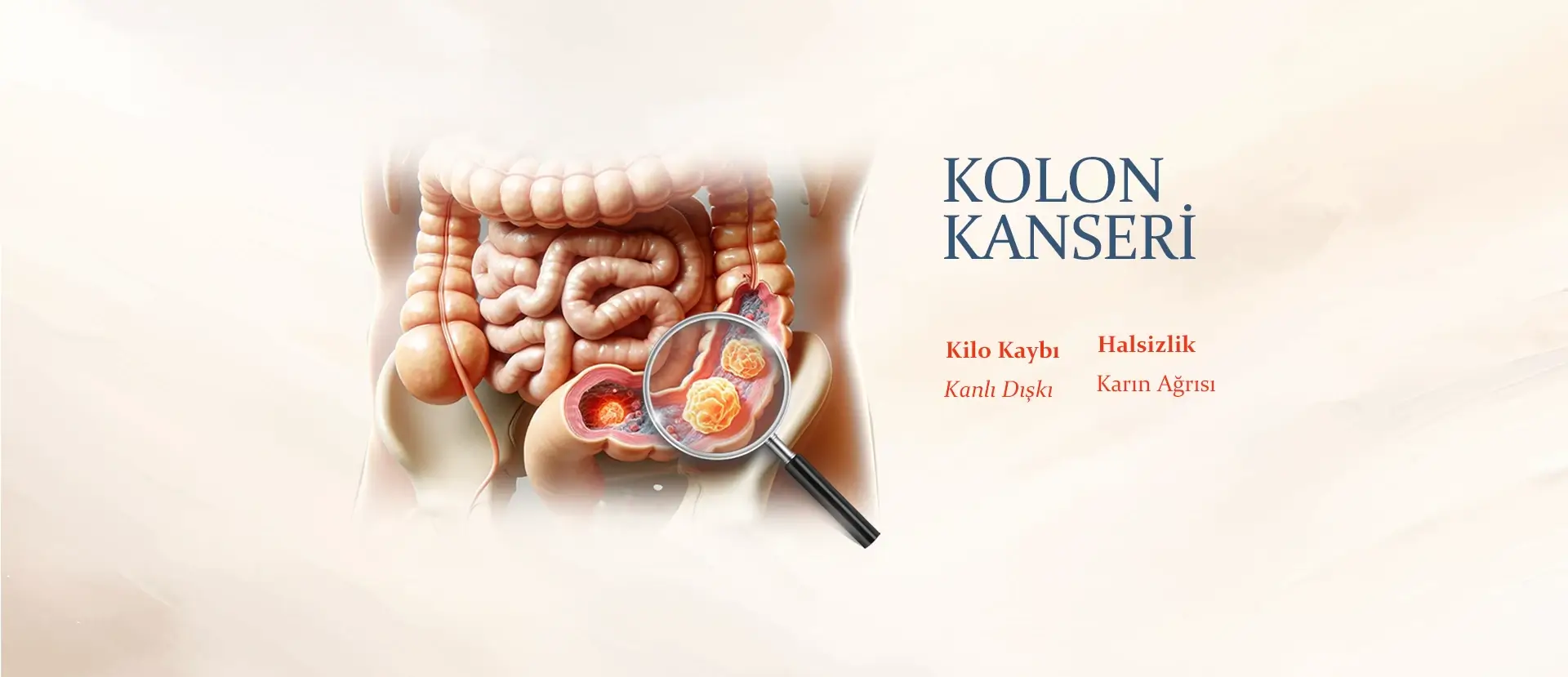 Kolon (Bağırsak) Kanseri